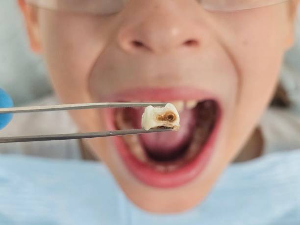 Best Emergency Cosmetic Dentistry in Manchester, MI