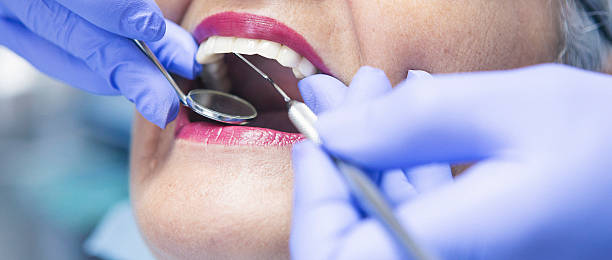Best Emergency Root Canal Treatment in Manchester, MI